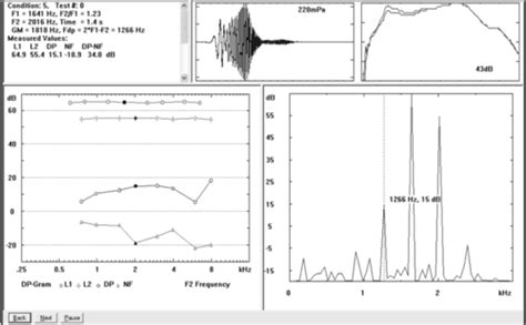 Otoacoustic Emissions (OAEs) and Tympanometry.